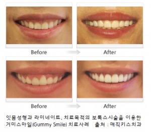 아름다운미소치과 이미지