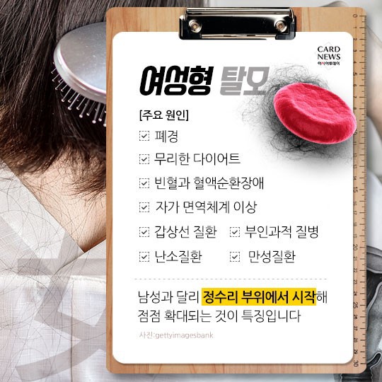 [카드뉴스] “소중한 머리카락 왜 자꾸 빠질까?”... 탈모 원인 및 치료법? 